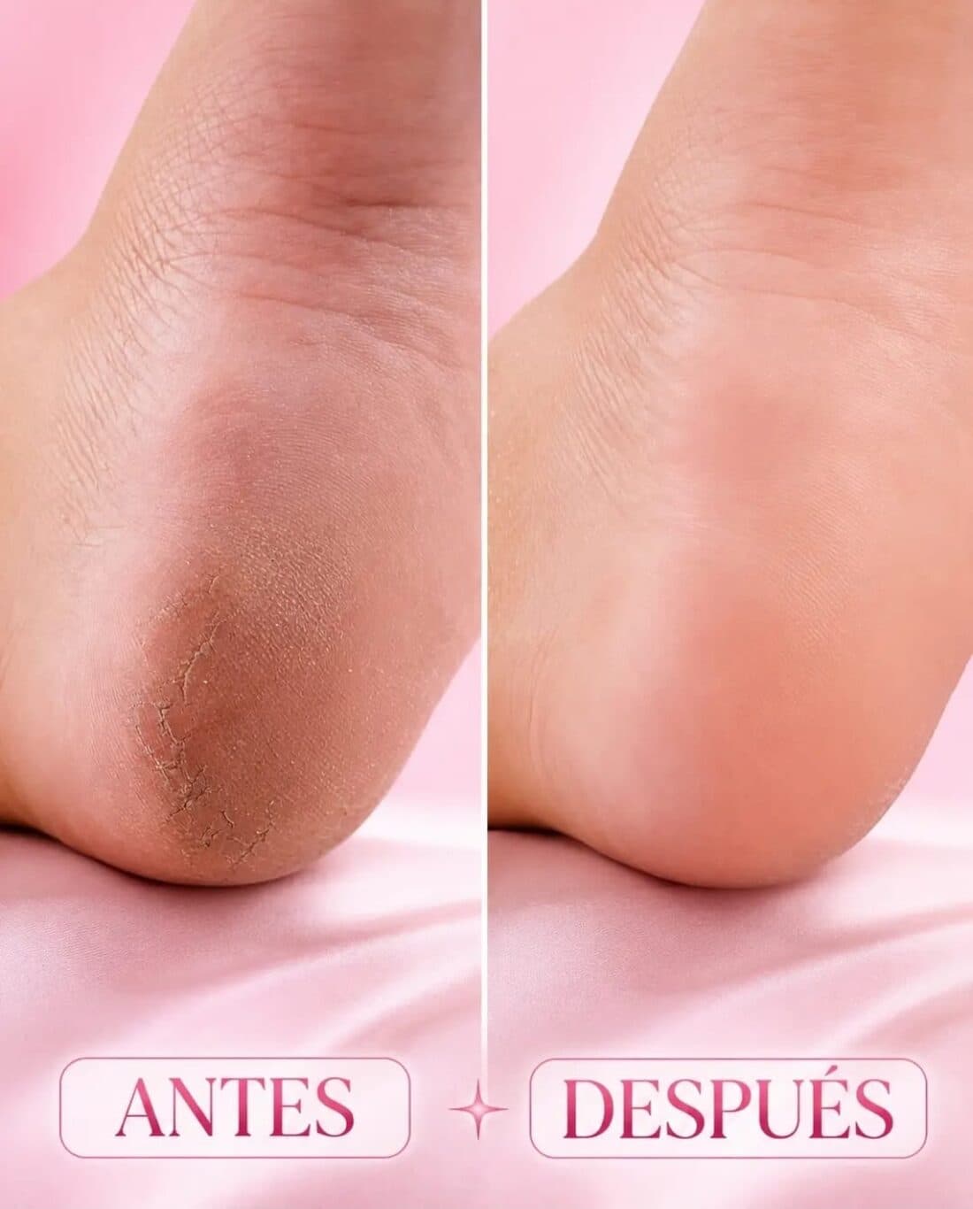 Antes y después
